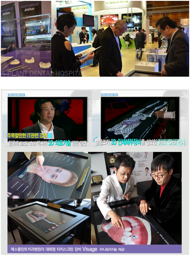 [3DCT임플란트]3D임플란트,세계적인명성 관련 이미지 4