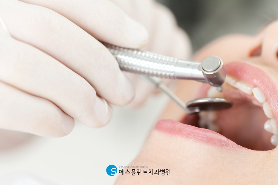 Apgujeong Implant Surgery Time: How Long Does It Take?! image 2