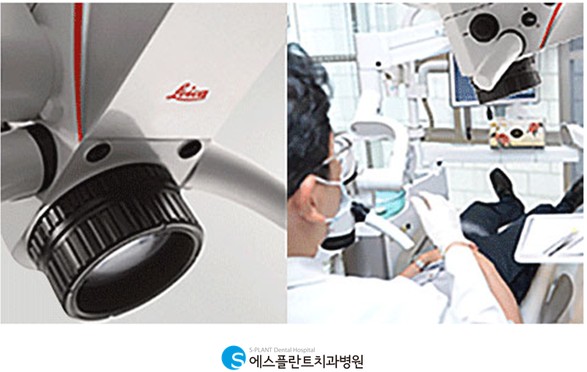 신경치료로 자연치아 살릴 수 있어요. 관련 이미지 6
