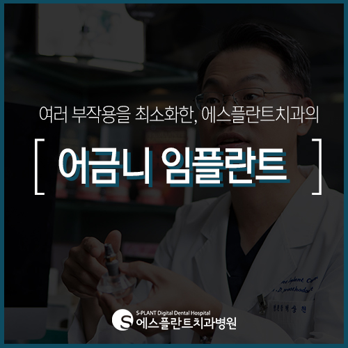 [어금니 임플란트] 중요한 기능을 담당하는 어금니, 에스플란트 치과에서 관리하세요 관련 이미지 3