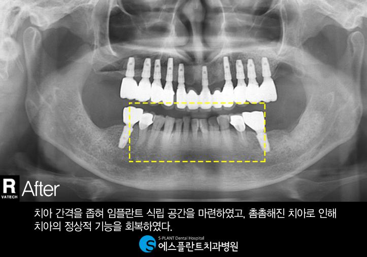 치과에서분과별진료와협진진료는정말중요합니다. 관련 이미지 4