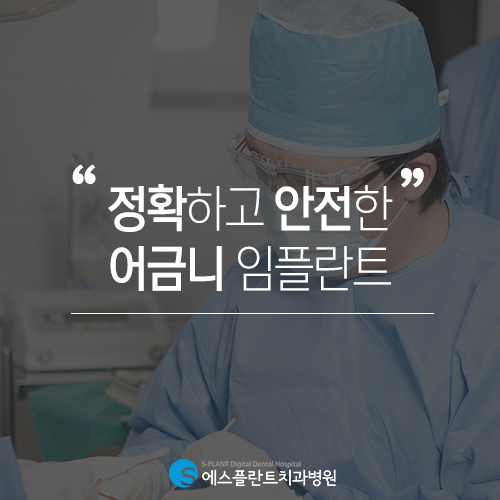 에스플란트 치과병원의 정확하고 안전한 어금니 임플란트 관련 이미지 3