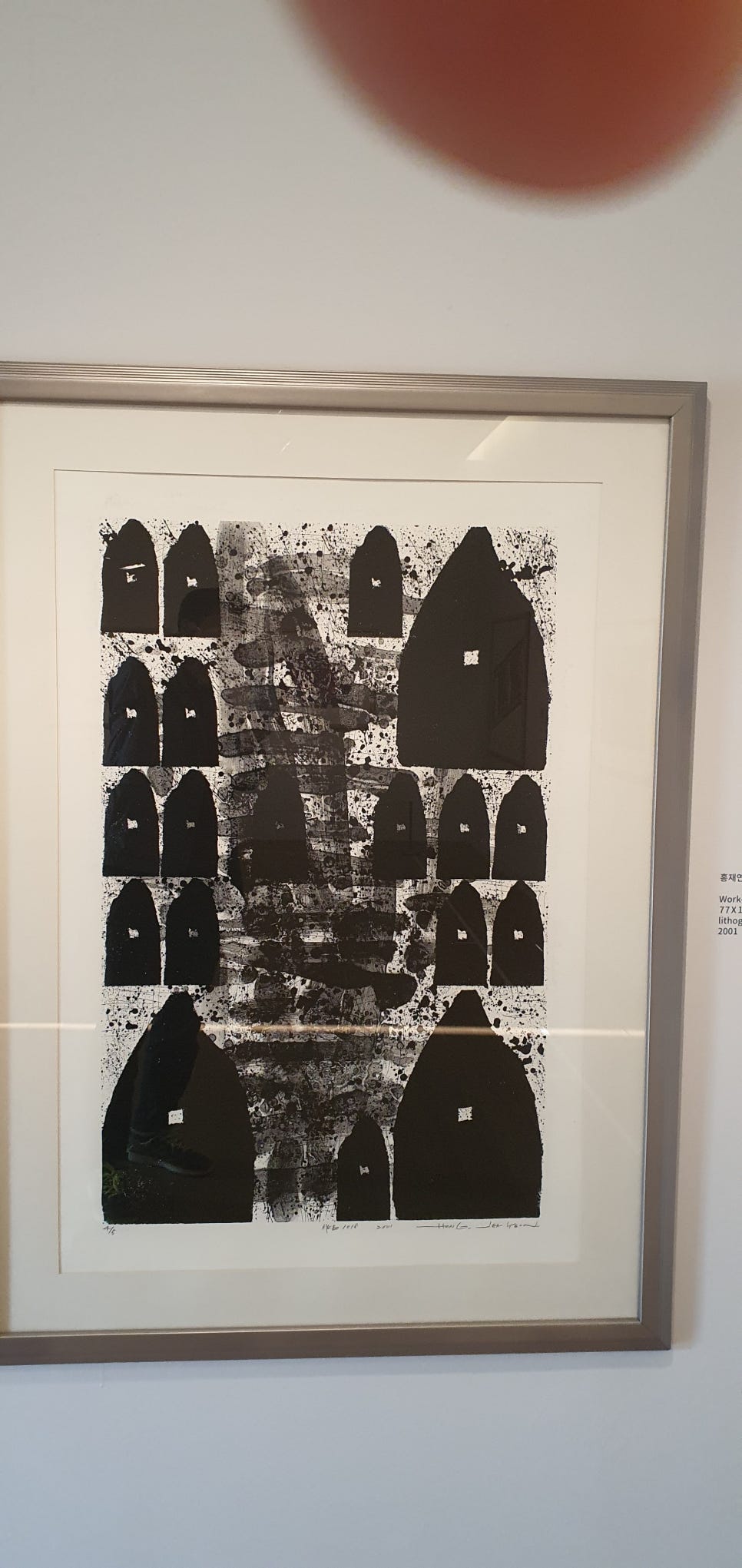 손발톱 흑색종과 흑색선36(&Musium SAN2) 관련 이미지 21