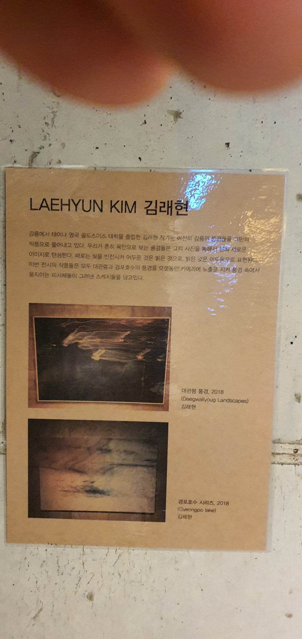 발톱무좀과 내성발톱30(&하슬라현대미술관1) 관련 이미지 22