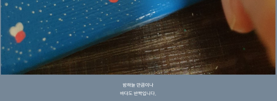 손발톱 흑색종과 흑색선26(&손그림송송2) 관련 이미지 22