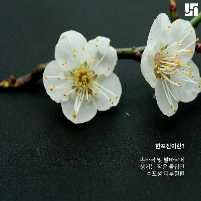 재발률 높은 한포진 예방하기 위한 방법 관련 이미지 2