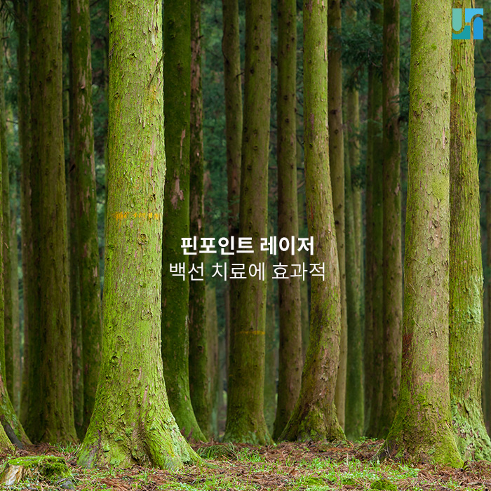 무좀이라고도 불리는 족부 백선, 핀 포인트 레이저로 해결해 봐요! 관련 이미지 1