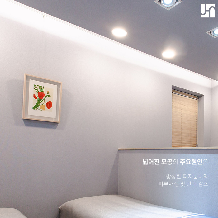 속상한 모공 흉터, 레이저로 개선하고 싶다면 관련 이미지 2