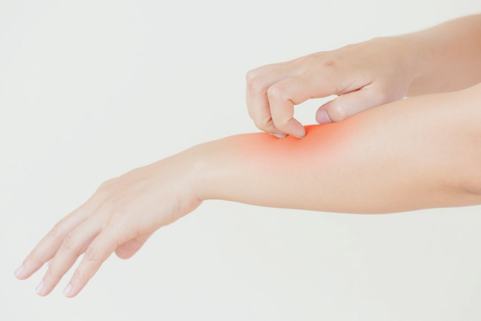 방배동 피부과 피부 건조증 원인 치료 로션만 바른다고 해결되지 않는 이유 관련 이미지 3