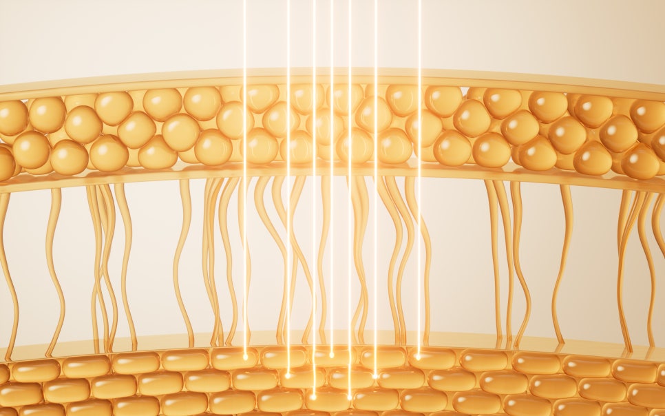 사당역 피부과 모공 축소에 도움이 되는 레이저 치료방법 관련 이미지 3