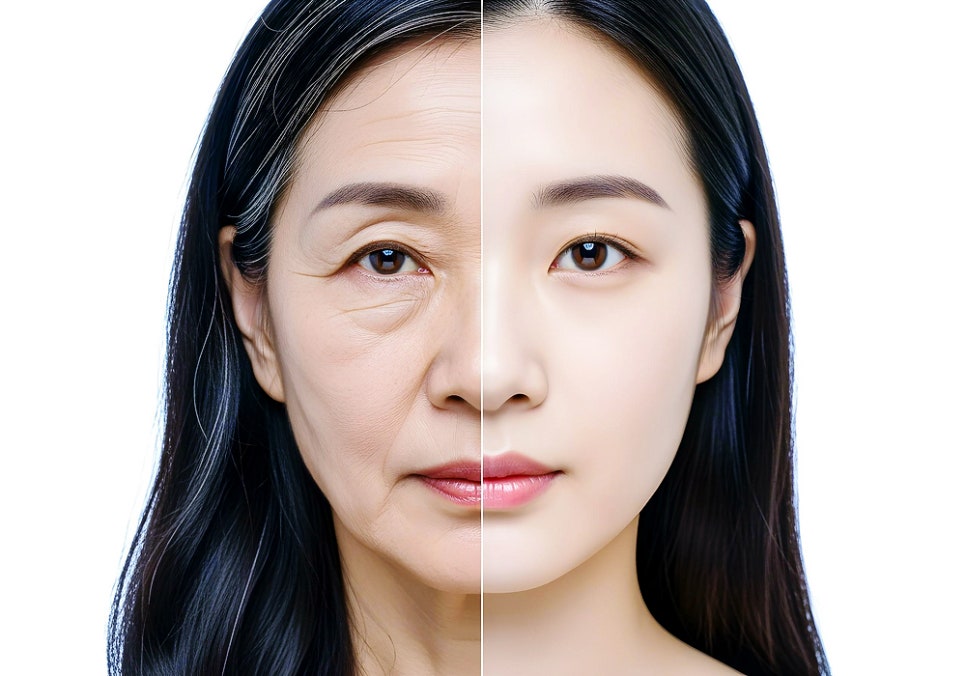 Sadang-dong Dermatology Clinic Facial Lifting Treatments: Ways to Lift a Sagging Face Without Surgery image 1