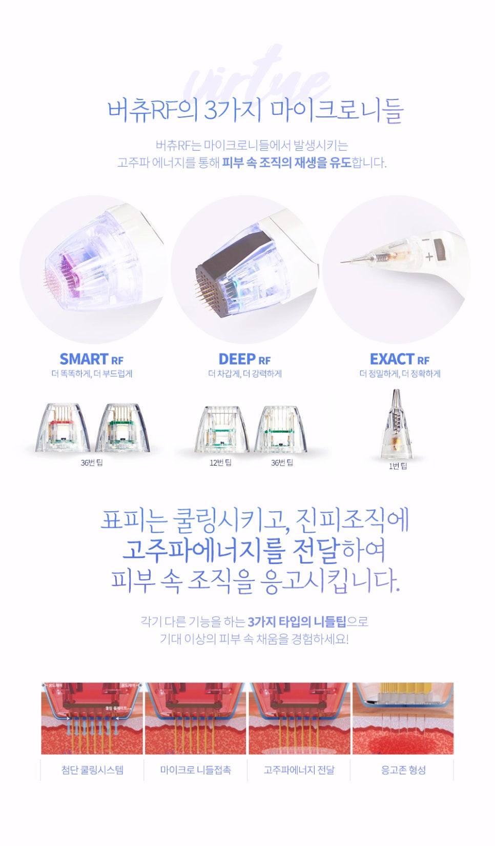 내방역 피부과 갑자기 생긴 붉은 튼살 흉터 레이저 피부과 치료가 효과적인 이유 관련 이미지 4