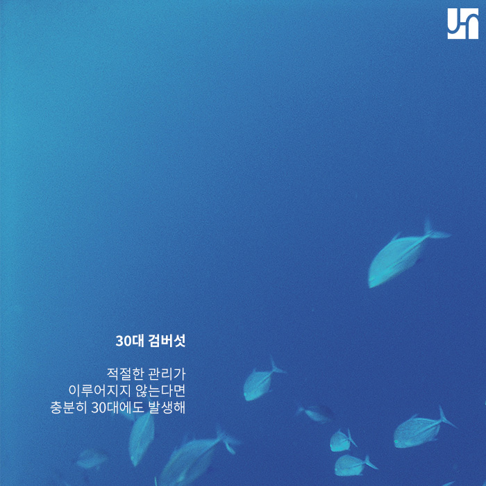 30대 검버섯 생길수 있어 주의 해야해 관련 이미지 3