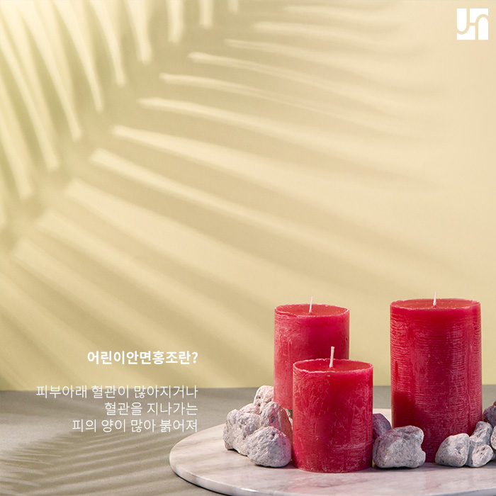 어린이 안면홍조 감염성 홍반이란 무엇일까? 관련 이미지 2