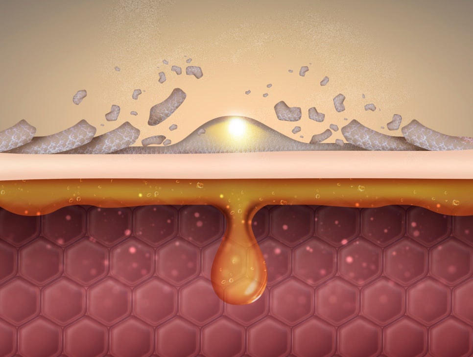 서초구 피부과 추워지는 날씨에 꼭 필요한 겨울철 스킨케어 방법 관련 이미지 4