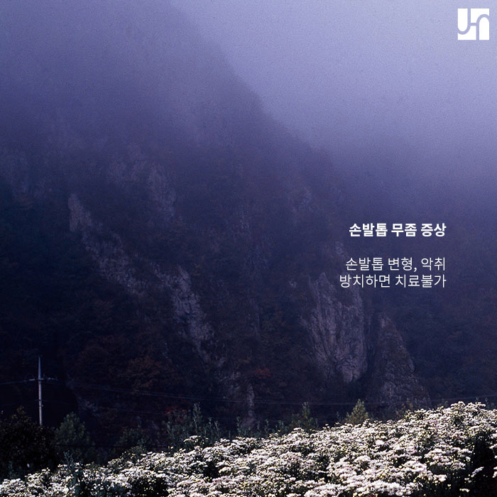 손발톱 무좀 원인을 알고 핀포인트레이저로 치료하세요 :: 방배역 전혜주피부과 관련 이미지 3