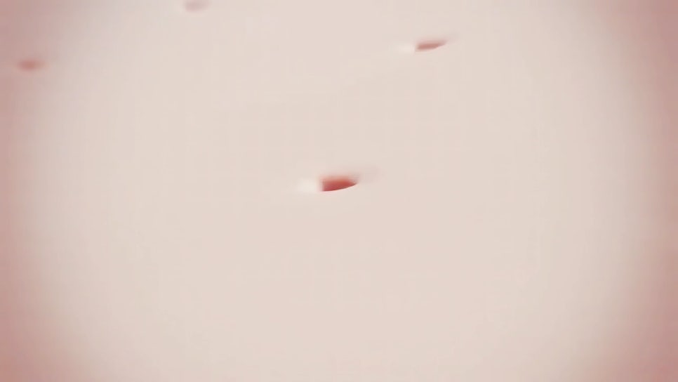 서초역 피부과 모공 레이저 효과 넓어진 모공과 거친 피부 결 개선하는 방법 관련 이미지 1