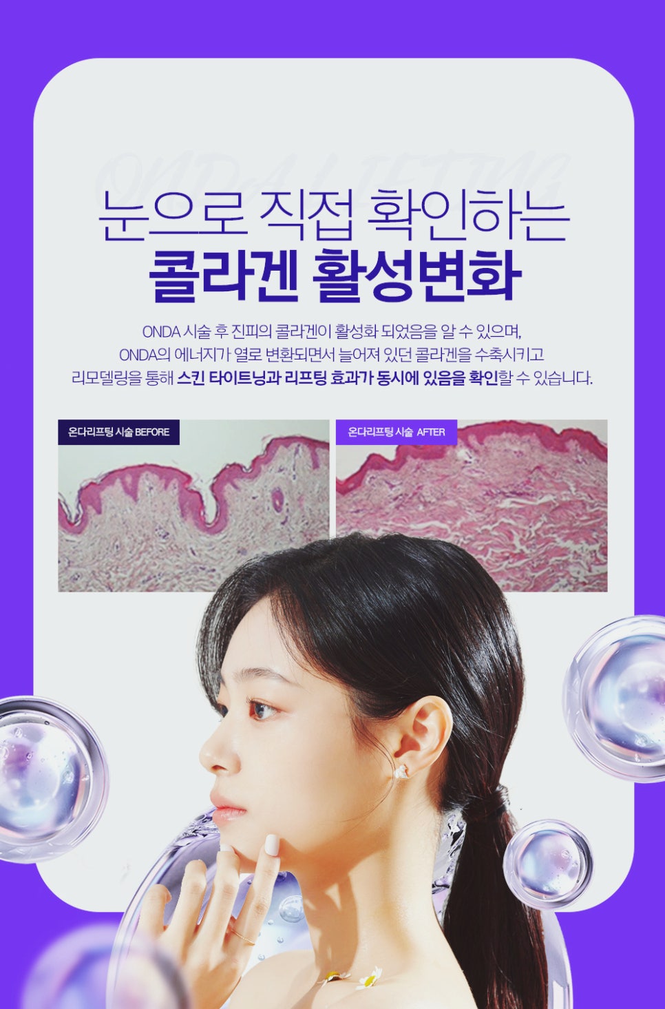 Seocho-gu Dermatology Clinic: Improving a Double Chin—There Is a Separate Reason It Does Not Disappear Even After Losing Weight image 5
