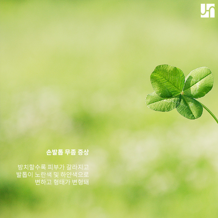 약물 치료로 역부족인 무좀, 핀 포인트 레이저로 치료하기 관련 이미지 2