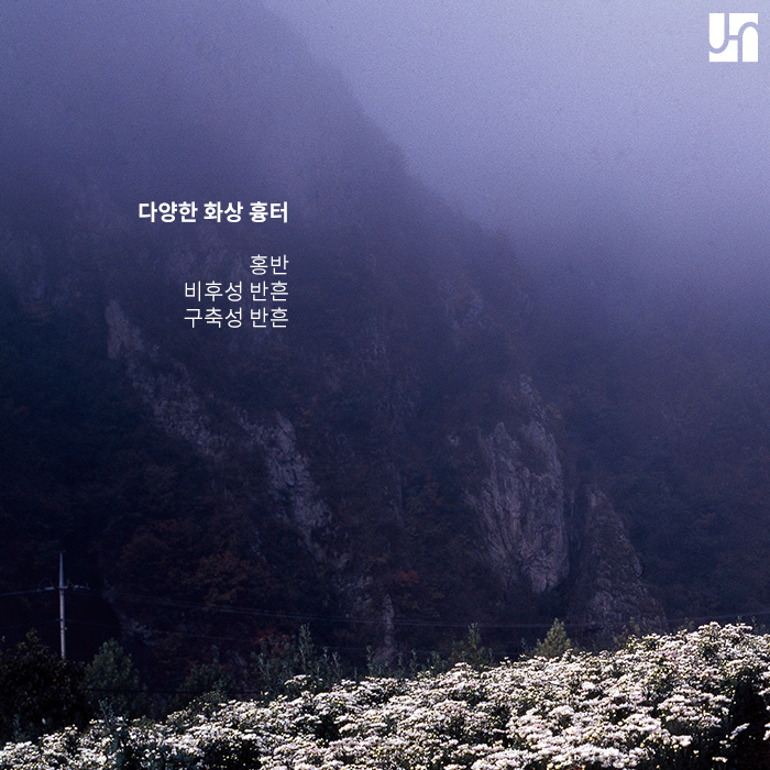 [방배동 피부과] 화상 흉터, 발생 초기에 치료 시작하는 것이 좋아요. 관련 이미지 4