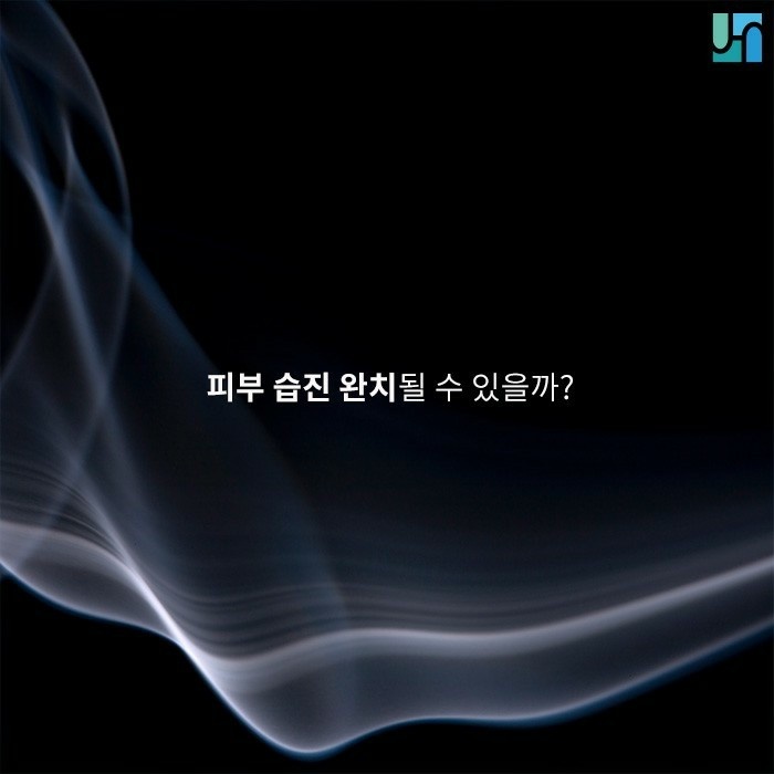 피부염, 습진으로부터 자유로워지고 싶다면 관련 이미지 1