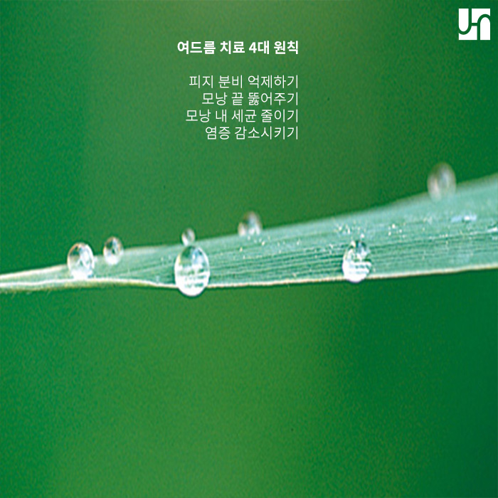 여드름 치료에 성공하고 싶다면 다음의 네 가지를 기억하세요! 관련 이미지 2