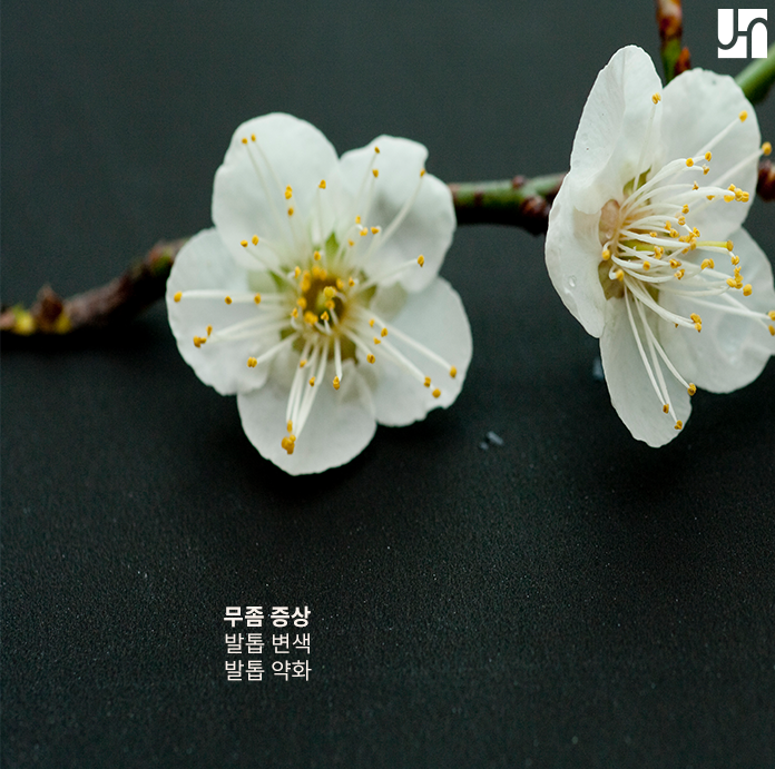 [방배역 피부과] 고민되는 무좀 치료엔 핀포인트 관련 이미지 3