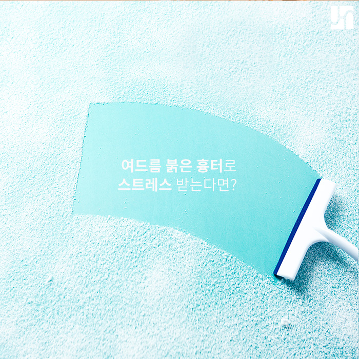 여드름, 붉은 흉터로 남지 않도록 관리하는 법 관련 이미지 1