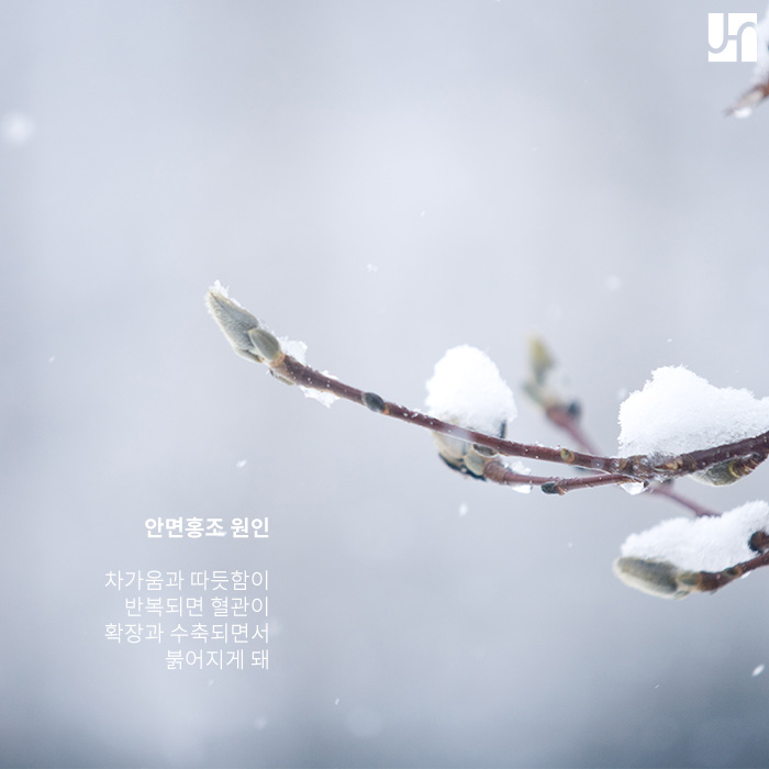 찬바람이 불면 나타날 수 있는 안면 홍조 치료는 원인에 맞게 이루어져야! 관련 이미지 2