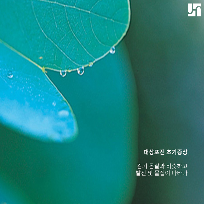 대상포진 초기증상은 무엇일까? 관련 이미지 3