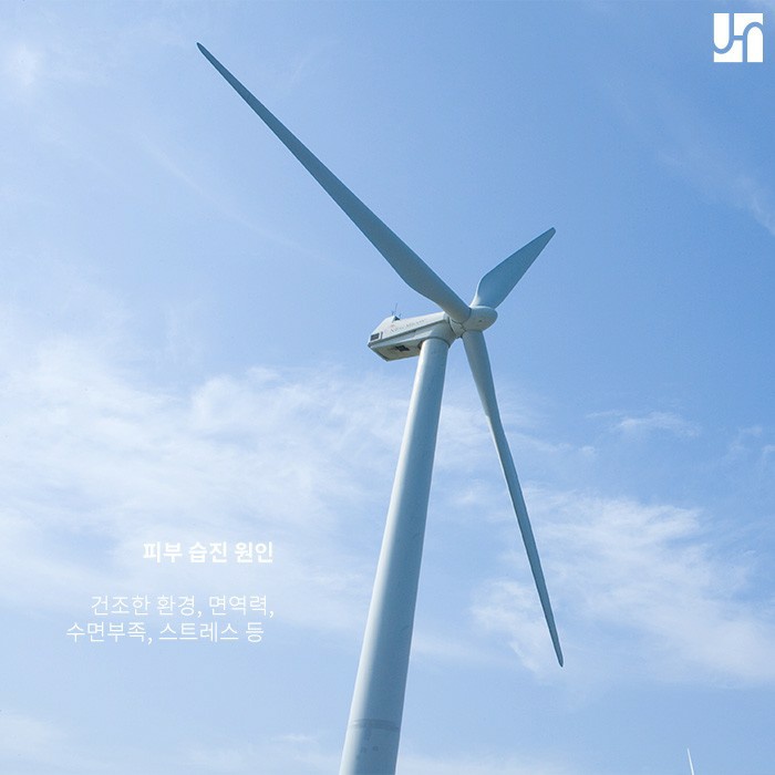 영아는 물론 성인에게도 생길 수 있는 지루 피부염 치료법은? 관련 이미지 2