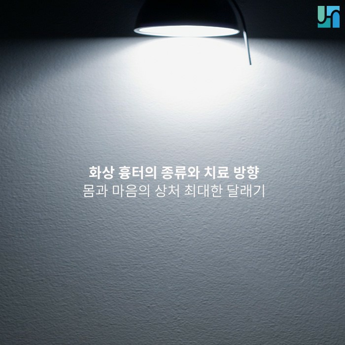 화상 흉터를 최소화하기 위해 알아야 할 것들 관련 이미지 1