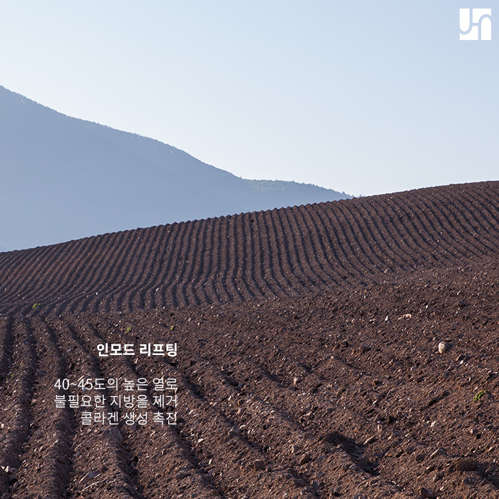 신경 쓰이는 이중턱, 인모드리프팅으로 해결! 관련 이미지 3