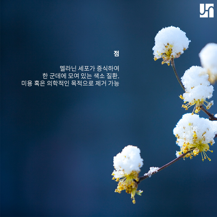 다양한 색소 질환, 발생 원인에 맞춘 치료 방법 관련 이미지 2