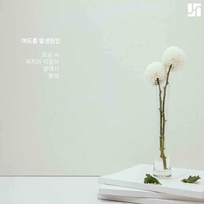 여드름 흉터로 남지 않도록 관리하는 방법 관련 이미지 2