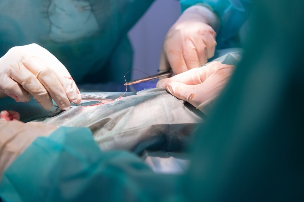 Naebang Station Dermatology Clinic: Surgical Scar Treatment—There Is a Reason Surgical Marks Do Not Disappear Over Time image 3