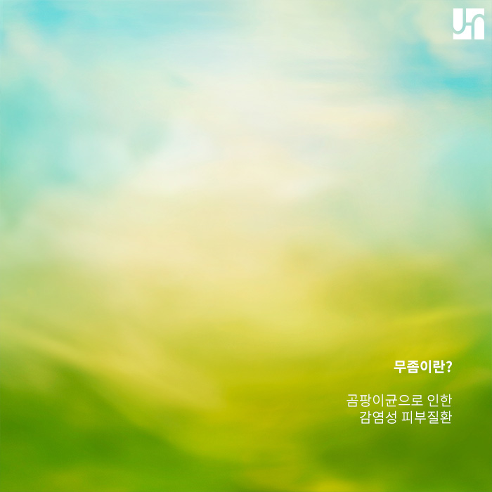 무좀과 습진의 가장 큰 차이는 무엇인가요? 관련 이미지 3