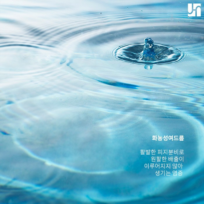 여드름 흉터로 남지 않도록 관리하는 방법 관련 이미지 2