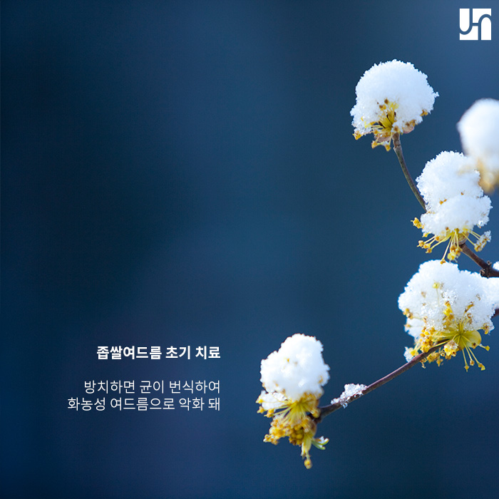 방배역 피부과, 피부 좁쌀여드름 이유가 궁금하다면? 관련 이미지 3