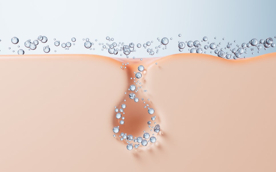 내방역 피부과 넓고 쳐진 모공 관리로 매끈한 달걀 피부 되는 법 관련 이미지 3