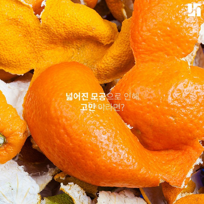 넓어진 모공 고민, 더 이상 혼자 하지 마세요! 관련 이미지 1