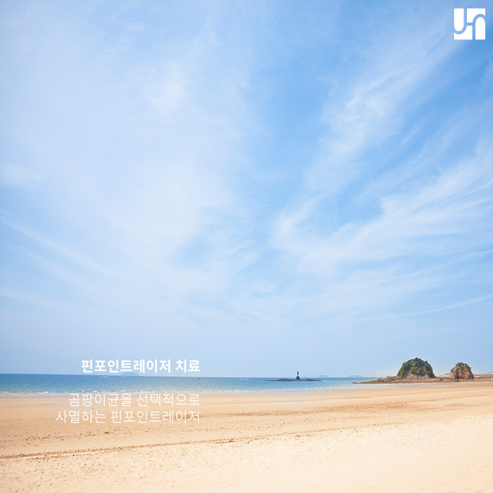 손발톱 무좀 치료는 핀포인트레이저로 말끔하게! 관련 이미지 3