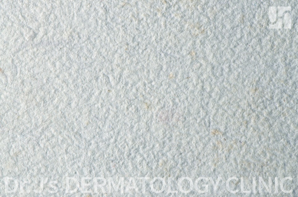 여름 농가진 증상 주의, 농가진 후유증 없도록 관련 이미지 2