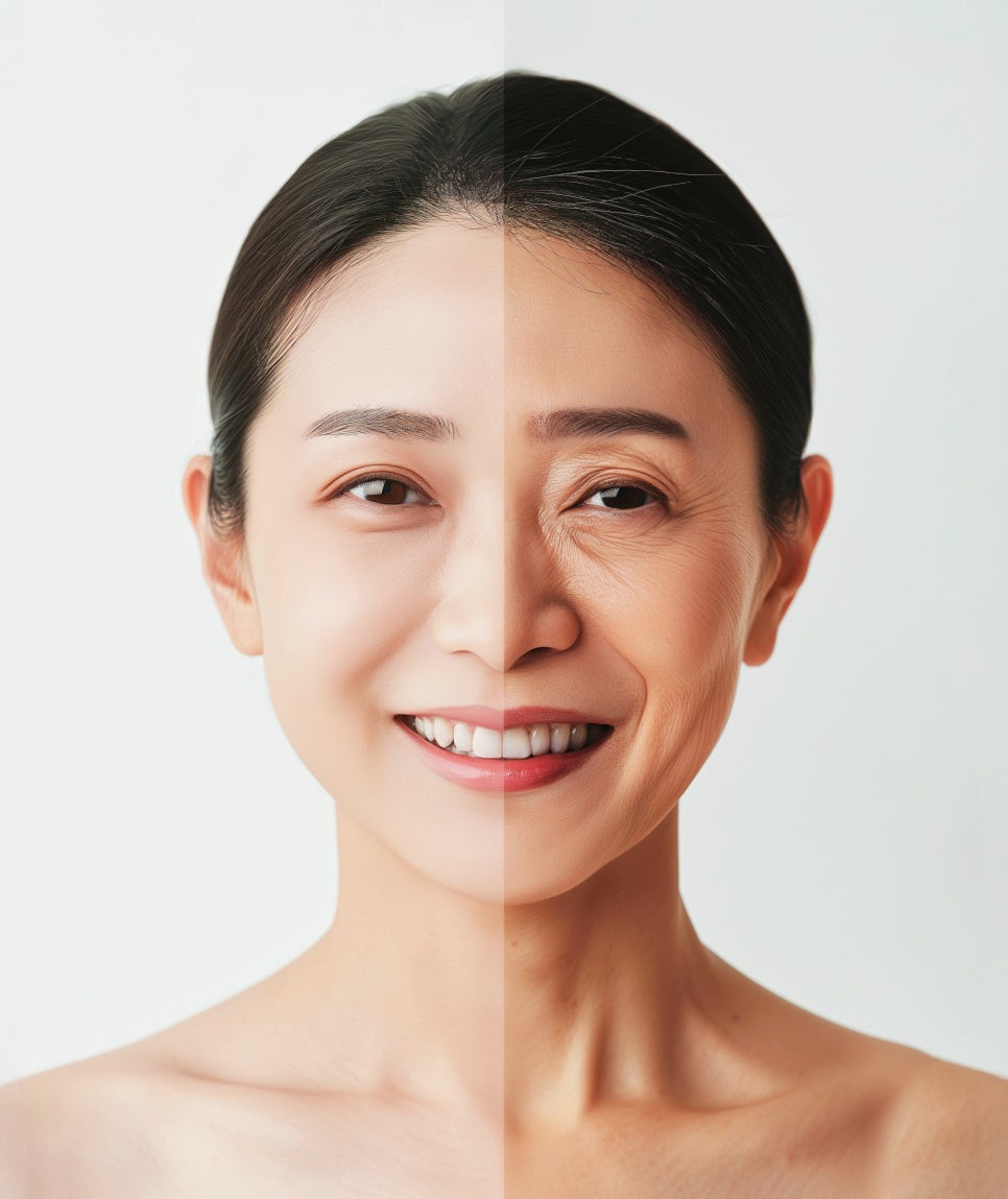 서초동 피부과 온다리프팅 이중턱과 팔자 주름 개선에 효과가 있을까? 관련 이미지 1