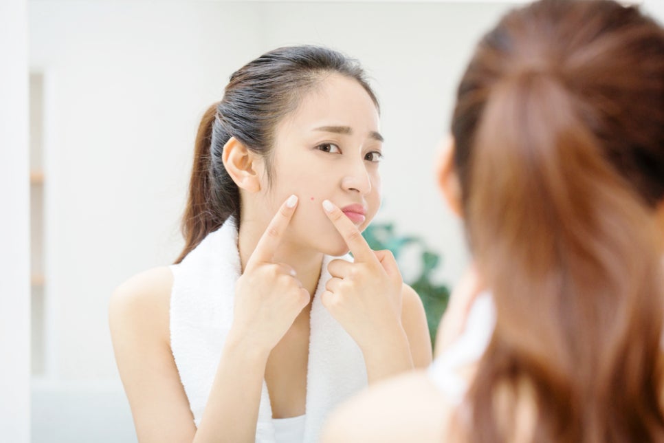 Sadang Station Dermatology Clinic: How to Approach Pigmentation Treatment When Acne Marks Remain Brown image 3