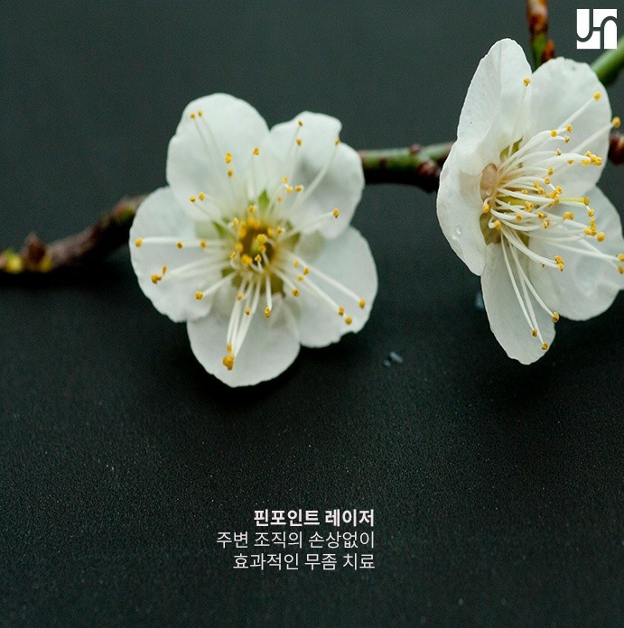 손발톱 관리, 핀포인트 레이저로 해보세요! 관련 이미지 3