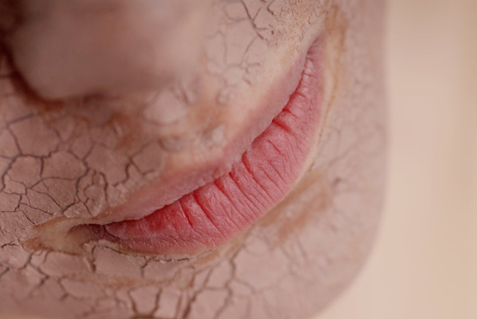 서초구 피부과 추워지는 날씨에 꼭 필요한 겨울철 스킨케어 방법 관련 이미지 2