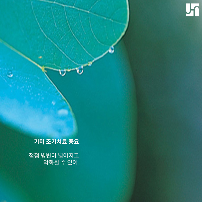 기미 주근깨 레이저를 통해 개선하자 관련 이미지 3