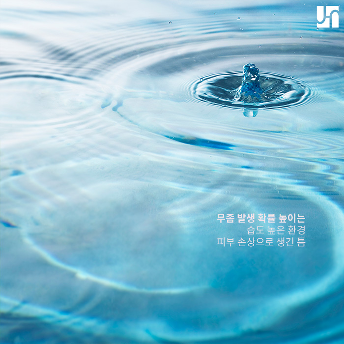 가려움증 유발 무좀 치료하고 발미인 되기 관련 이미지 2