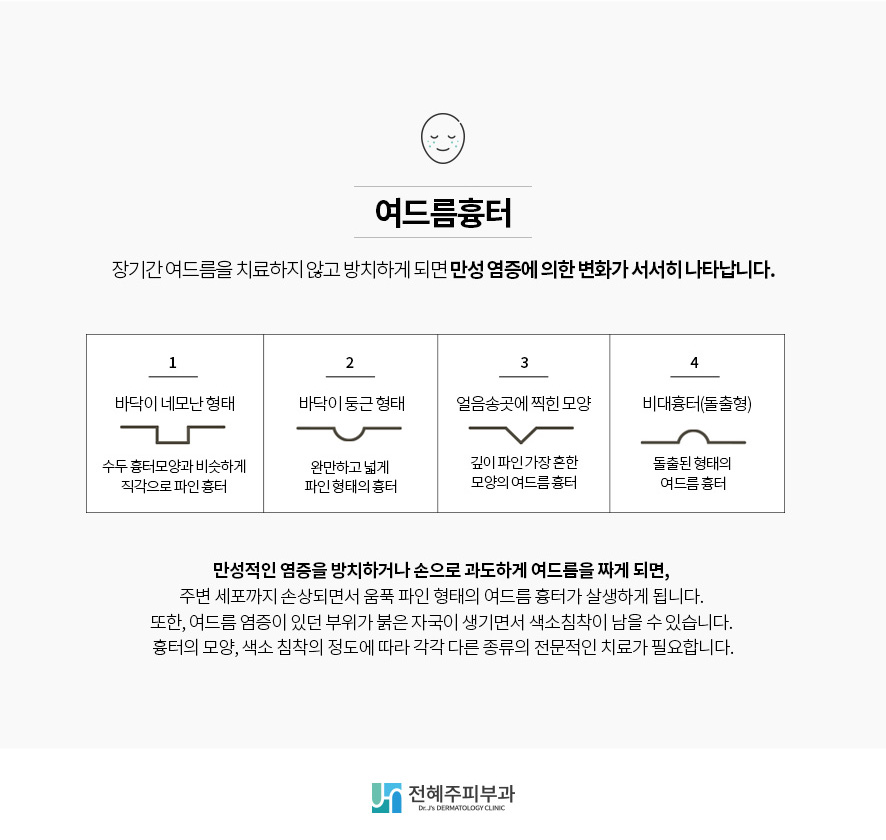 서초역 피부과, 여드름이 생기는 원인 무엇인가요? 관련 이미지 6